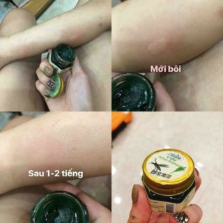 Cao sả Green Herb Balmchống và trị  MUỖI ĐỐT Thái Lan