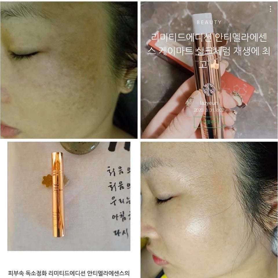 Serum  nám 💖FREESHIP💖 Serum nám  Anti Mela Serum - From.Your Skin HALIN8686K | BigBuy360 - bigbuy360.vn