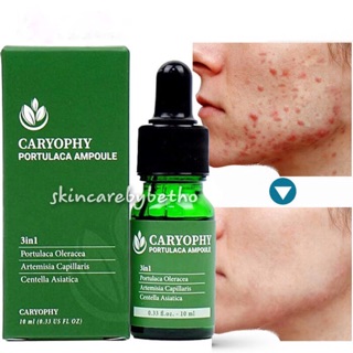 Serum Caryophy 10ml