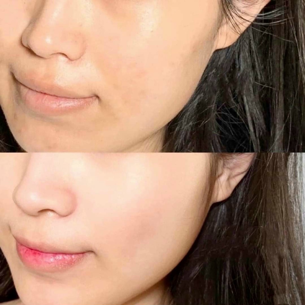 Tế Bào Gốc Serum Dưỡng Da - Full hộp