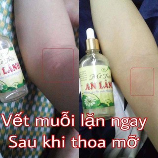 MỠ TRĂN DƯỢC LIỆU AN LÀNH