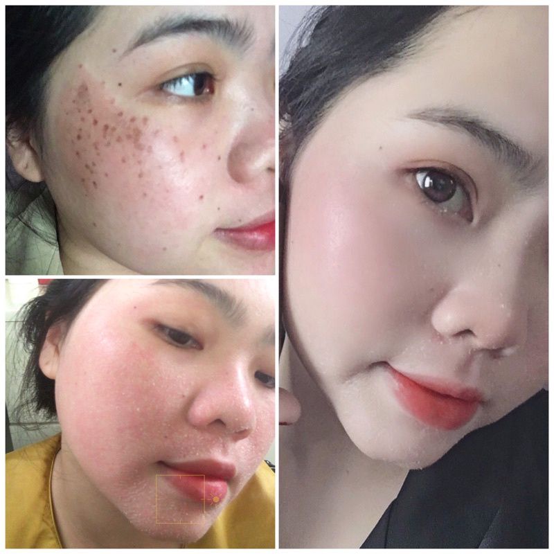 Bộ đôi tái tạo da cực hot