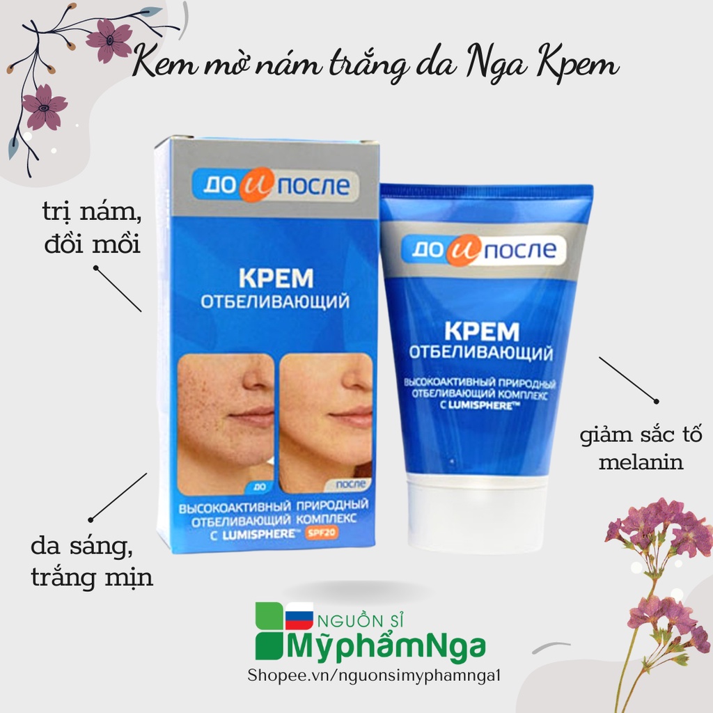 Kem xóa nám Kpem Nga - Kem mờ nám trắng da Nga Kpem