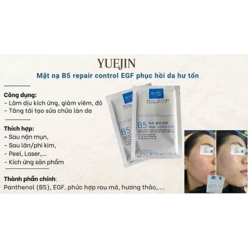 COMBO 100 Mặt nạ phục hồi cấp ẩm Yuejin B5 Repair Control EGF
