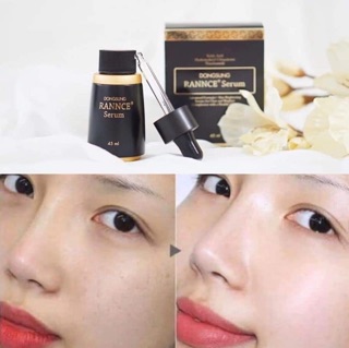 Serum Nám Dongsung Rannce 45ml