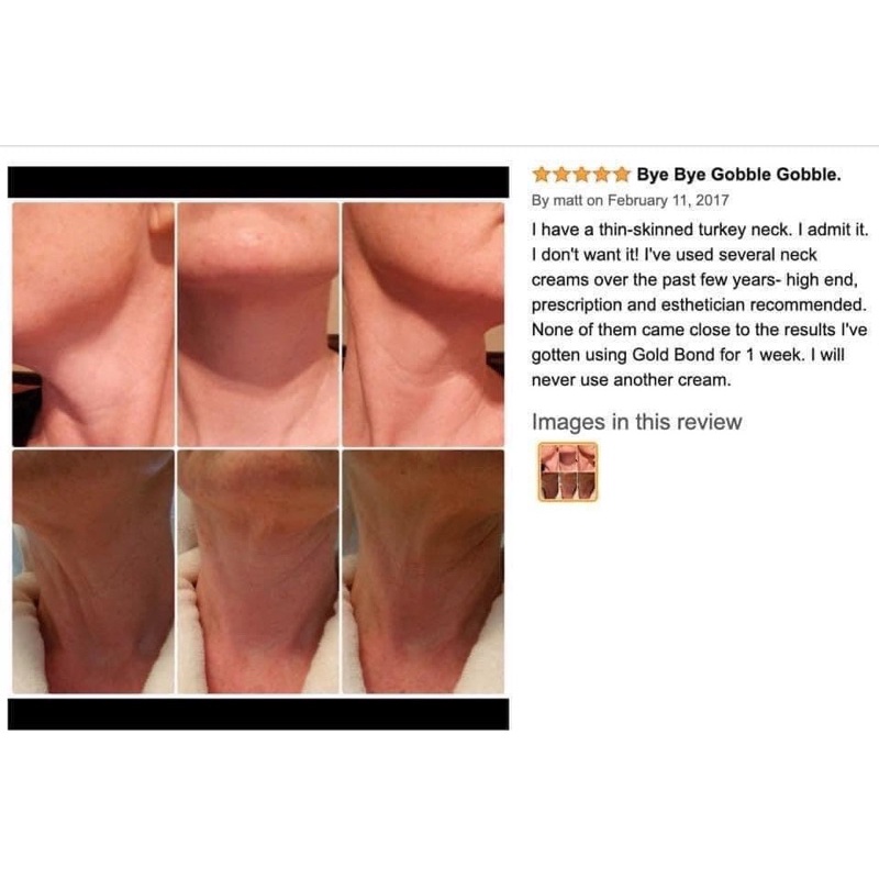 Kem dưỡng da vùng cổ Gold Bond Firming Neck & Chest Cream