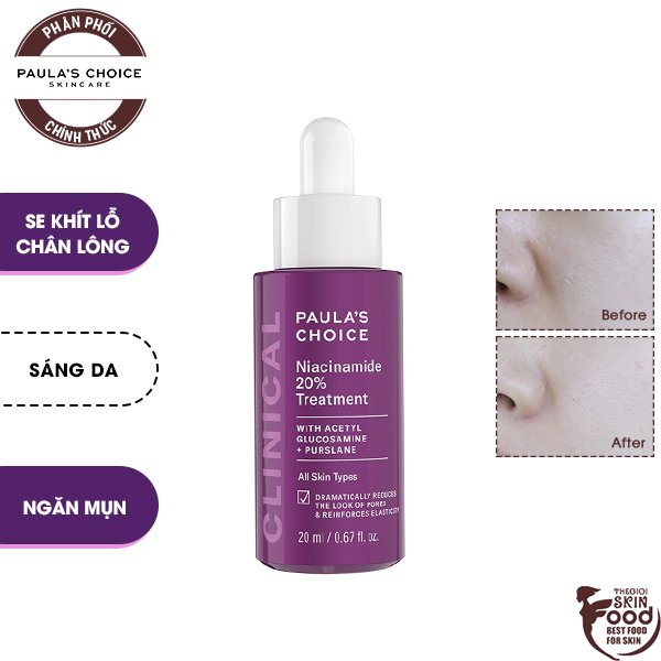 Tinh Chất Dưỡng Da Se Khít Lỗ Chân Lông Paula's Choice Niacinamide 20% Treatment 20ml