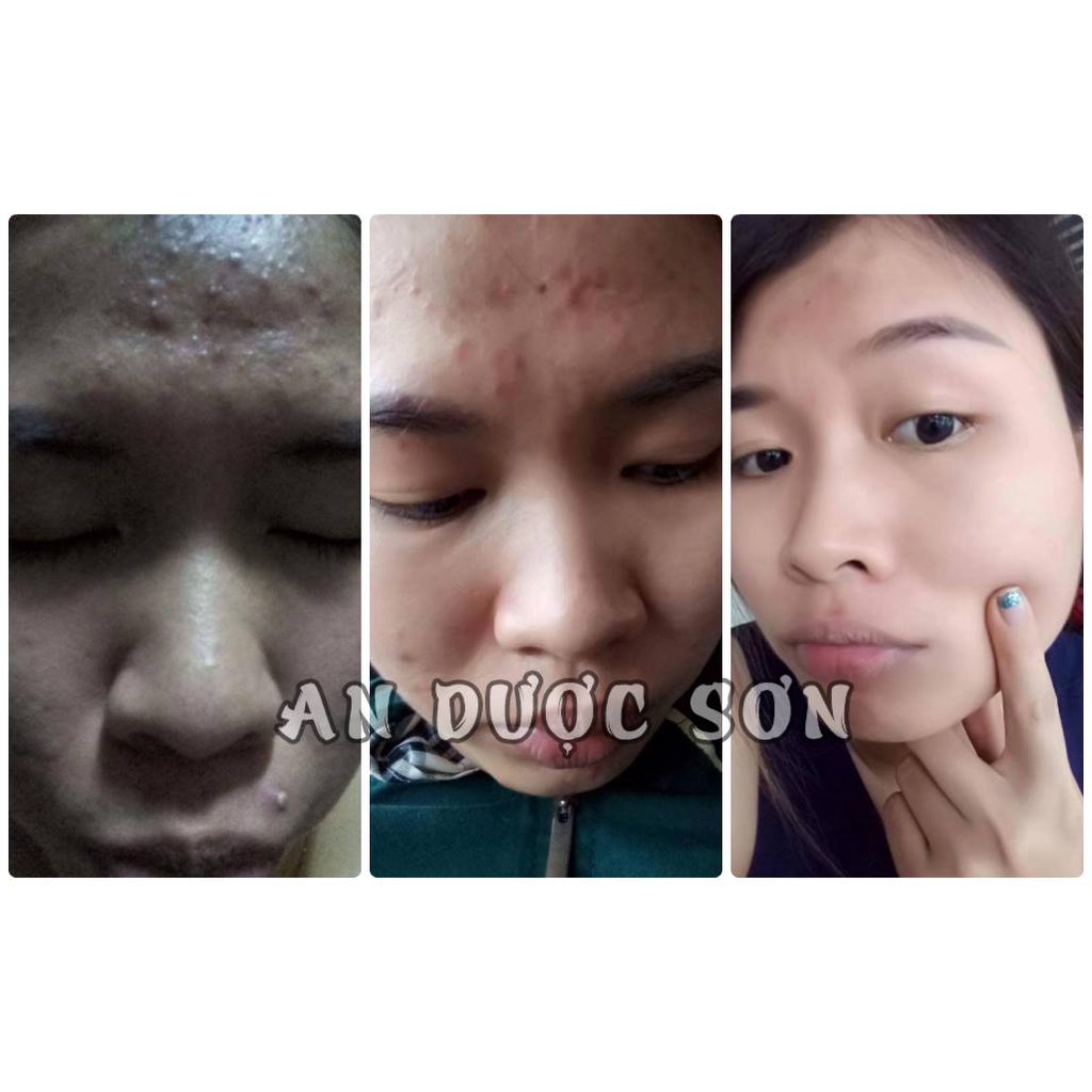 Serum An Dược Sơn 30ml - Serum Tái Tạo Da An Dược Sơn