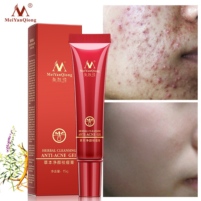 Kem Chăm Sóc Da Mặt MeiYanQiong 15g Làm Sáng Da Cải Thiện Độ Thô Ráp Và Xỉn Màu | BigBuy360 - bigbuy360.vn