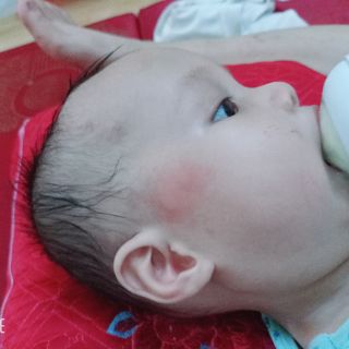 Kem chống muỗi mogi