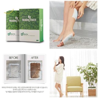 Miếng dán thải độc chân Healing patch 30 miếng