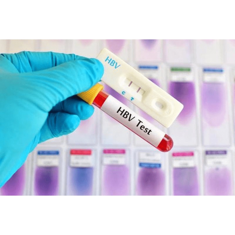 Test viêm gan B một bước HBsAg Hộp/50 test