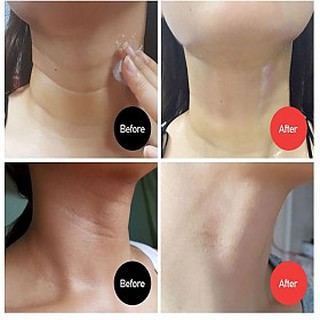 Kem Dưỡng Chống Lão Hóa Vùng Cổ Medi-Peel Naite Thread Neck Cream