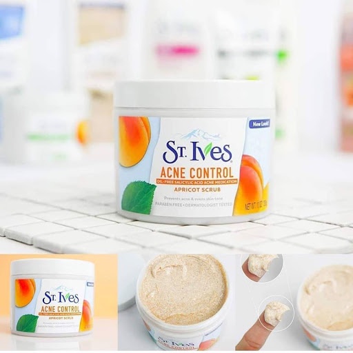 Tẩy Tế Bào Chết St.Ives Acne Control Apricot Scrub 283gr, Tẩy Da Chết Ngừa Mụn, Hương Mơ Chính Hãng Mỹ