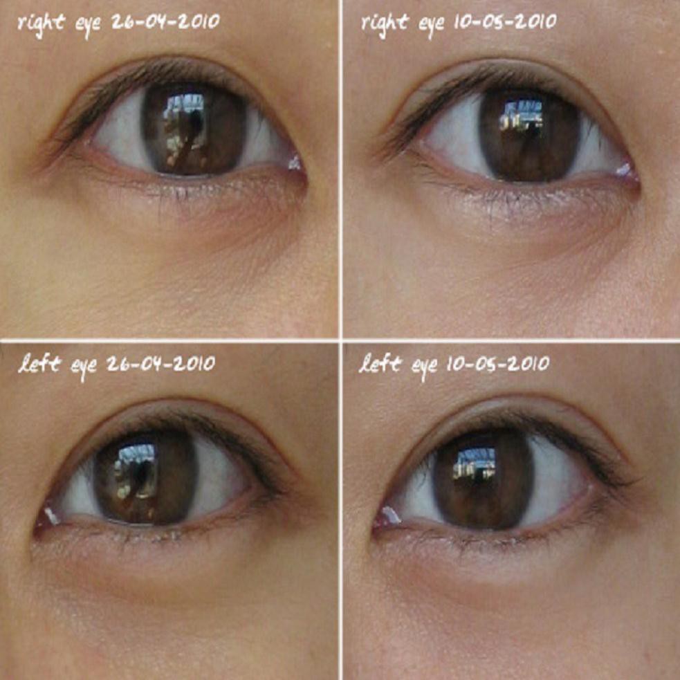 Kiehl's Powerful Wrinkle Reducing Eye Cream - Kem Dưỡng Mắt, Giảm Nếp Nhăn 14ml Date T7/2022 | BigBuy360 - bigbuy360.vn