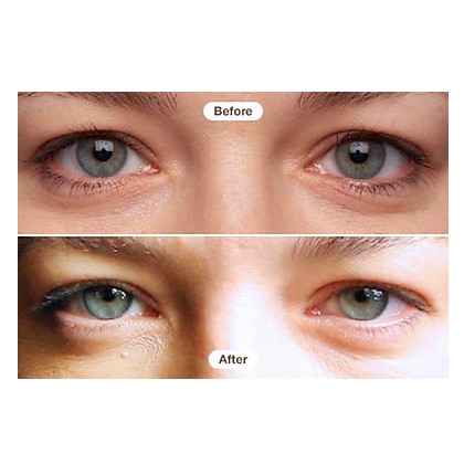 Kem dưỡng mắt giảm thâm và nếp nhăn RoC 15ml fullsize (Bill Mỹ)