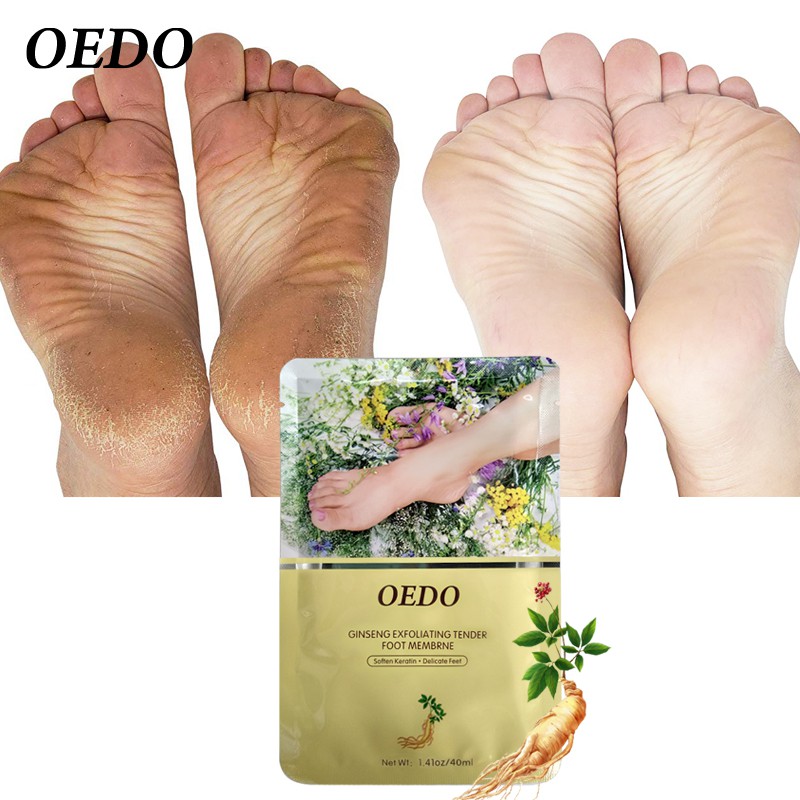 Kem chiết xuất hoa hồng OEDO làm trắng và dưỡng da tay + 2 mặt nạ tẩy tế bào chết cho da chân mềm mại sạch sẽ | BigBuy360 - bigbuy360.vn