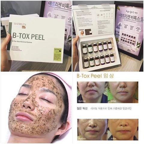 Thay da sinh học Hàn Quốc B-Tox BTOX PEEL MATRIGEN vi tảo có tem Hidden tag chông hàng giả