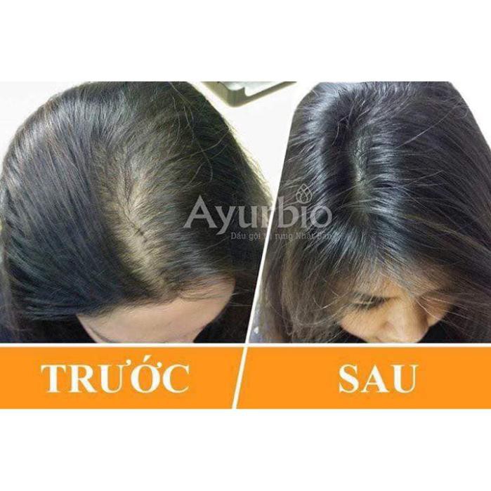 Dầu Gội TRỊ RỤNG TÓC AYURBIO NHẬT NỘI ĐỊA