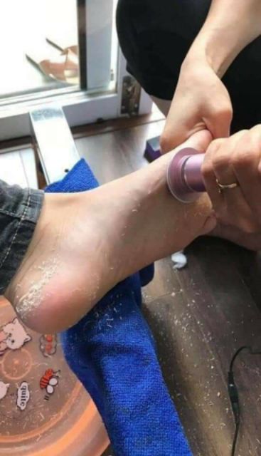 máy Chà Gót Chân ( bào da chết )