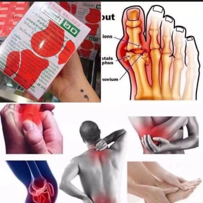 Hộp xương khớp Noxa 20