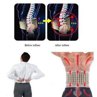 Đai hơi giải nén cột sống