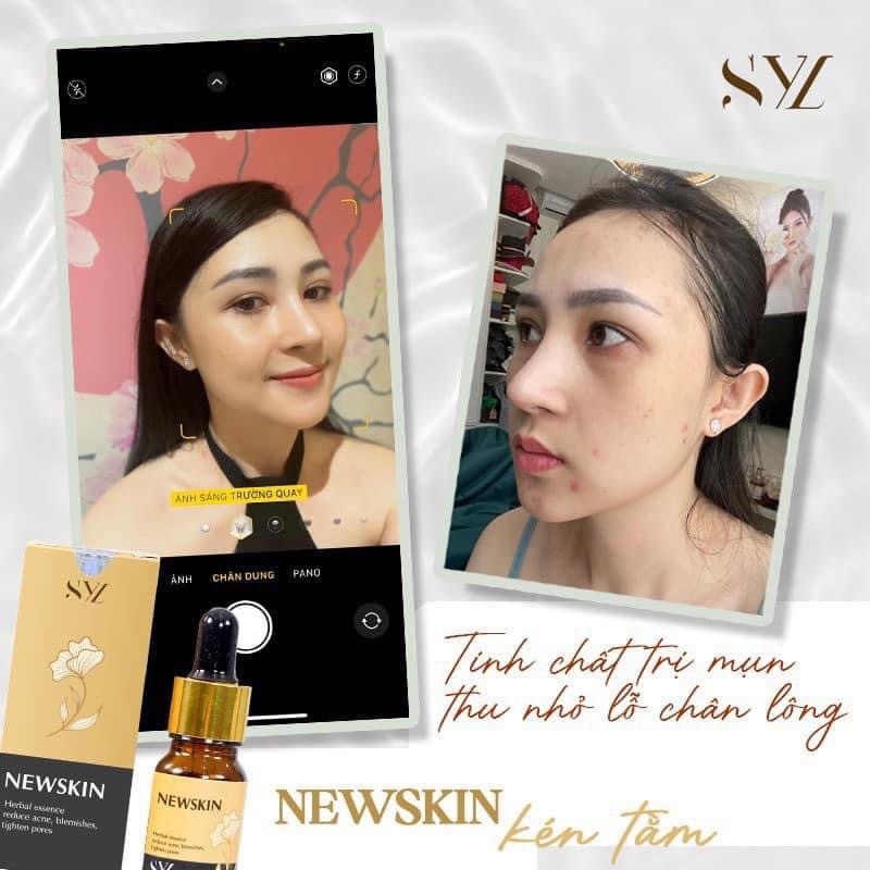 Tinh chất serum kén tằm Newskin Simming Sylic ngăn ngừa mụn chuyên sâu