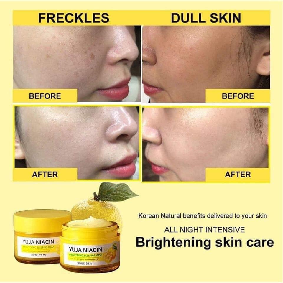 Set Some By Mi Yuja Niacin  Dưỡng Trắng Mờ Thâm Mụn 30 Days Miracle Brightening Starter Kit  Mini Hàn Quốc