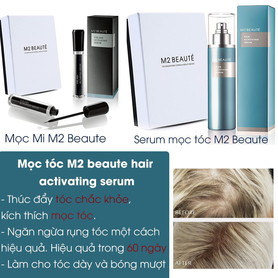 Serum mọc tóc M2 Beaute hair activating serum 120ml