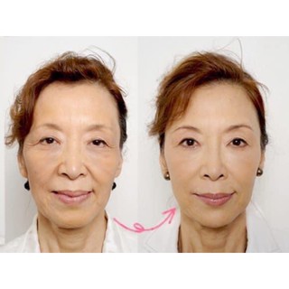 Serum HA tím cấp ẩm của nhật