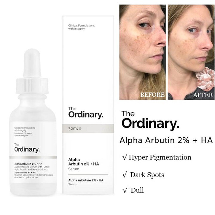 Serum The Ordinary Alpha Arbutin 2% + HA 30ml