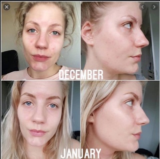 SERUM The Odinary 30ml và 60ml