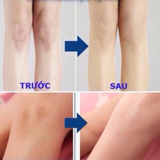 Tất phun Hàn Quốc Stocking  (cam kết chính hãng)