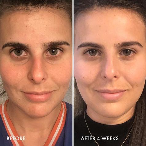 Wander Beauty kem dưỡng retinol 1% Do Not Disturb cấp nước giảm nhăn, mụn, chống lão hoá,sáng da, làm min da, săn chắc b