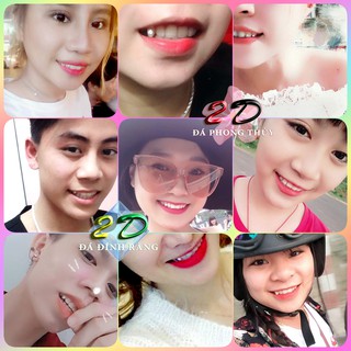 Đá đính răng cao cấp 2.7LY (loại vừa lớn)