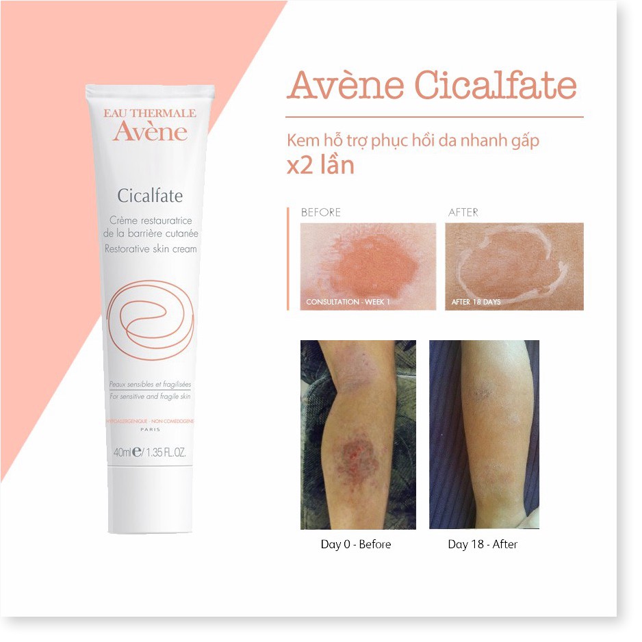 [Mã giảm giá mỹ phẩm chính hãng] Kem tái tạo hồi phục da Avene Cicalfate Repair Cream