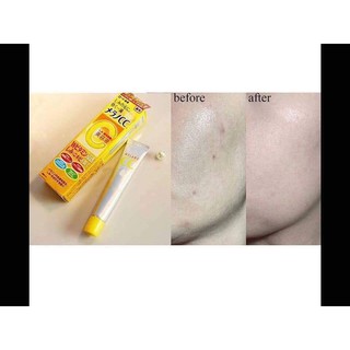 Serum CC Melano NHẬT BẢN