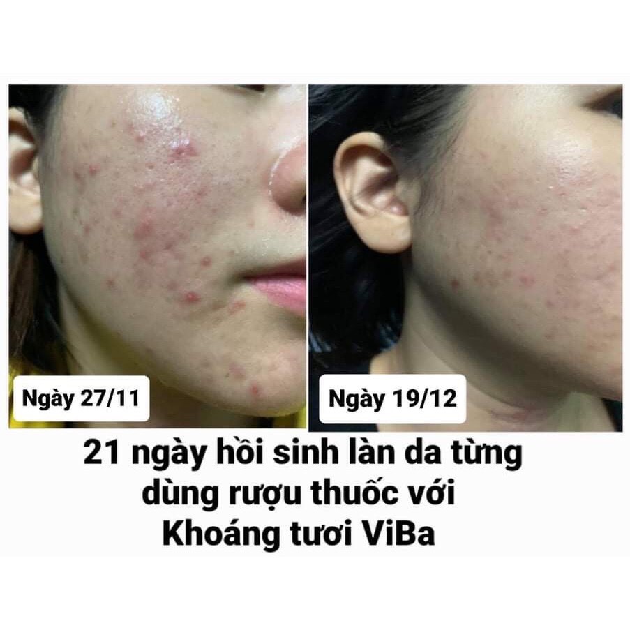 [Hàng chính hàng] [Rẻ nhất] XỊT KHOÁNG TƯƠI VIBA