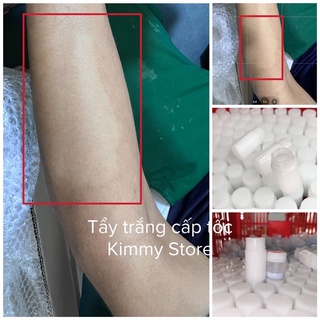 Tẩy trắng cấp tốc kimmy 1 cặp