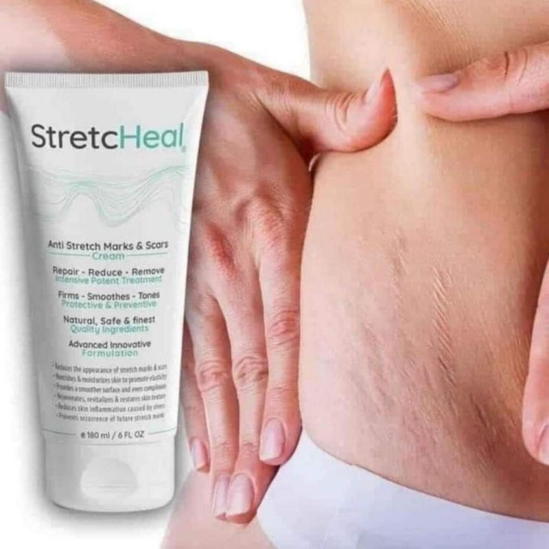 Kem bôi đánh bay rạn da Stretc heal làm mờ tất cả lọai rạn trắng rạn đỏ rạn dậy thì, rạn lâu năm hiệu quả số 1 tại Mỹ