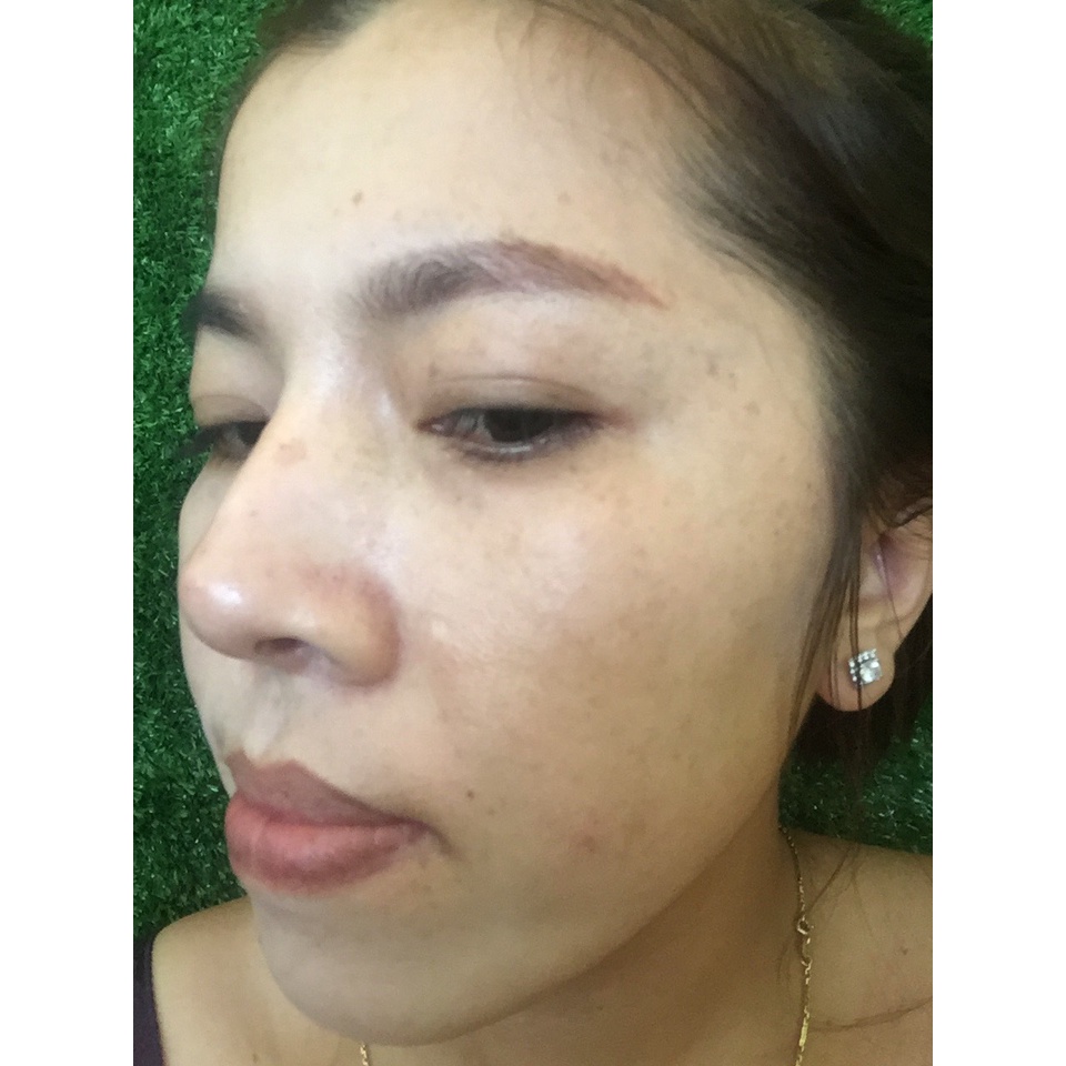 KEM TÁI TẠO TÁI SINH DA ĐÔNG Y l Loại Rỗ Bongmanh | BigBuy360 - bigbuy360.vn