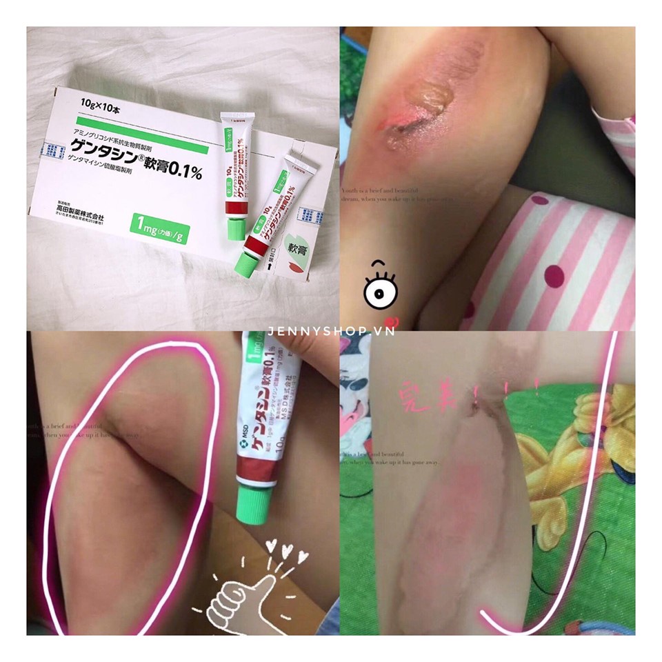 Kem Hỗ Trợ Mờ Sẹo Thâm Nhật Bản