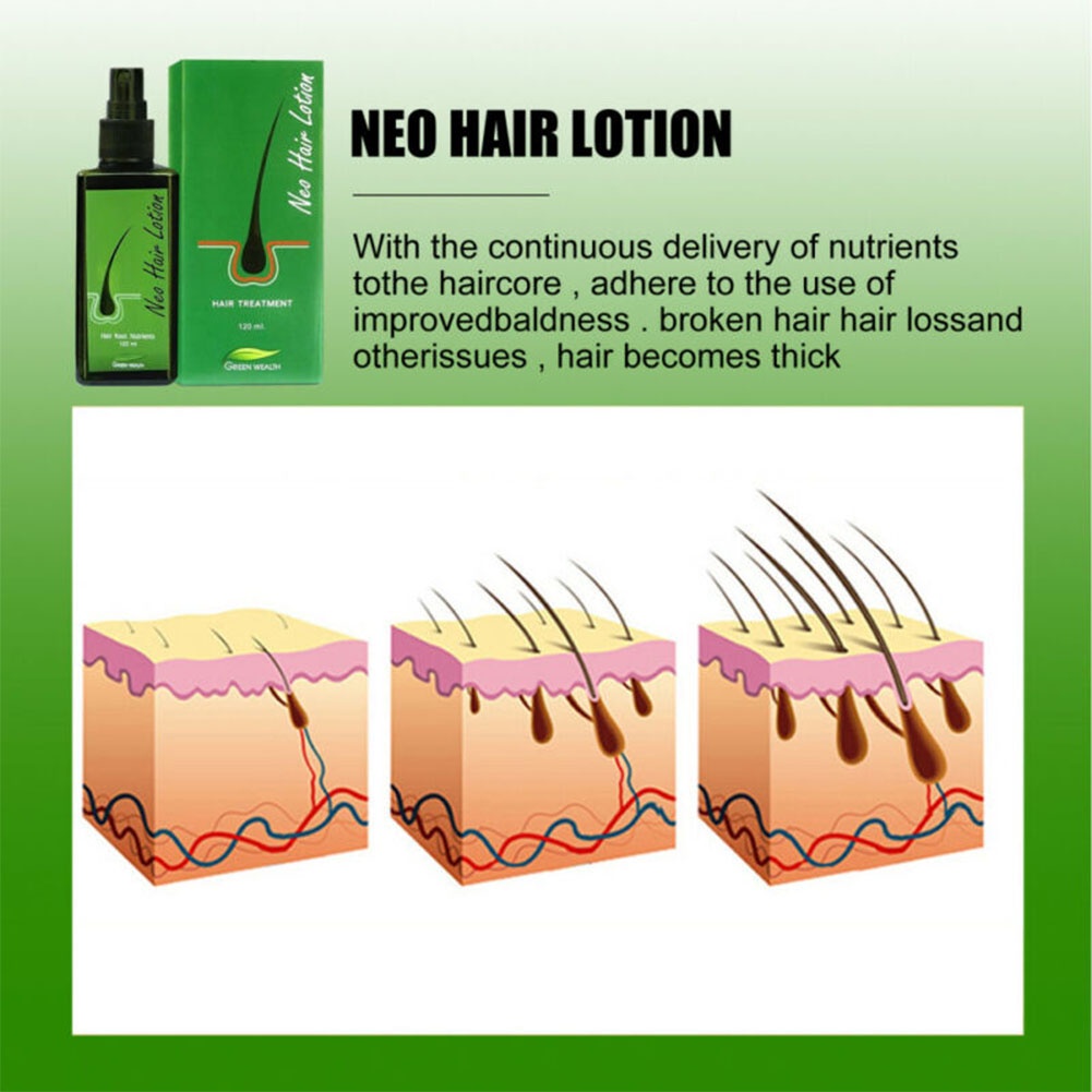 Hair Regrowth Lotion Haircare Hair Loss Oil Baldness Hair thinning 120ml Spray