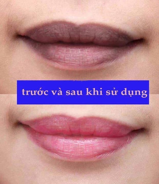 SON DƯỠNG MEDIHEAL LABOCARE PANTENO LIPS HEALBALM