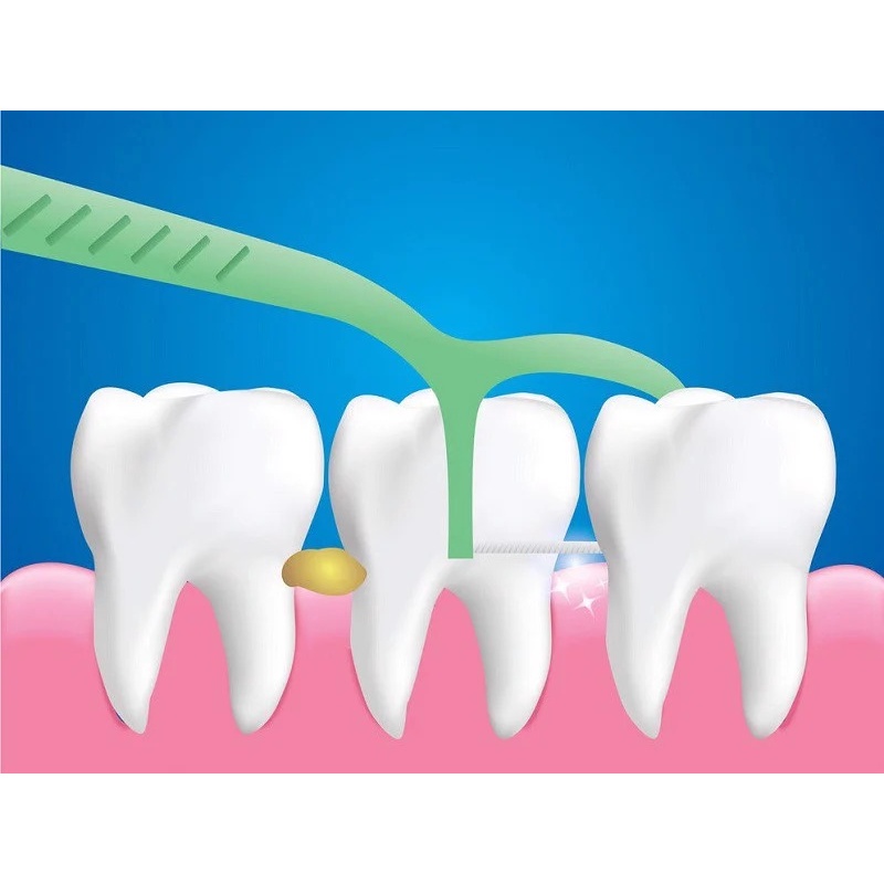 Tăm chỉ nha khoa Kichilachi