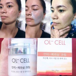 Ol- cell kem hút trị nám tàn nhang ol cell