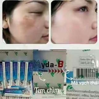 KEM NÁM MYDA-B THÁI LAN