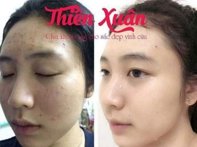 Thiên Xuân Bột Uống Trắng Da Thần Tốc Chính Hãng