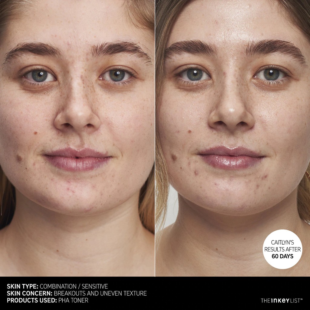 [BILL SEPHORA] ❤️FREESHIP❤️ NƯỚC HOA HỒNG THE INKEY LIST PHA TONER 100ML | BigBuy360 - bigbuy360.vn