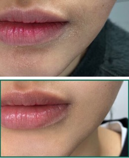 AHA – BHA – PHA 30 Days Miracle Toner